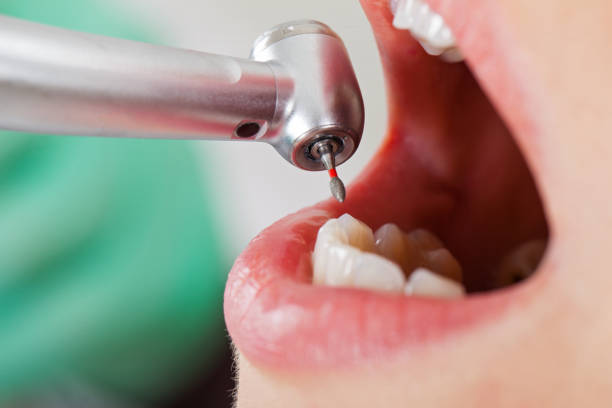 Best Emergency Treatment for Toothache in Copperopolis, CA